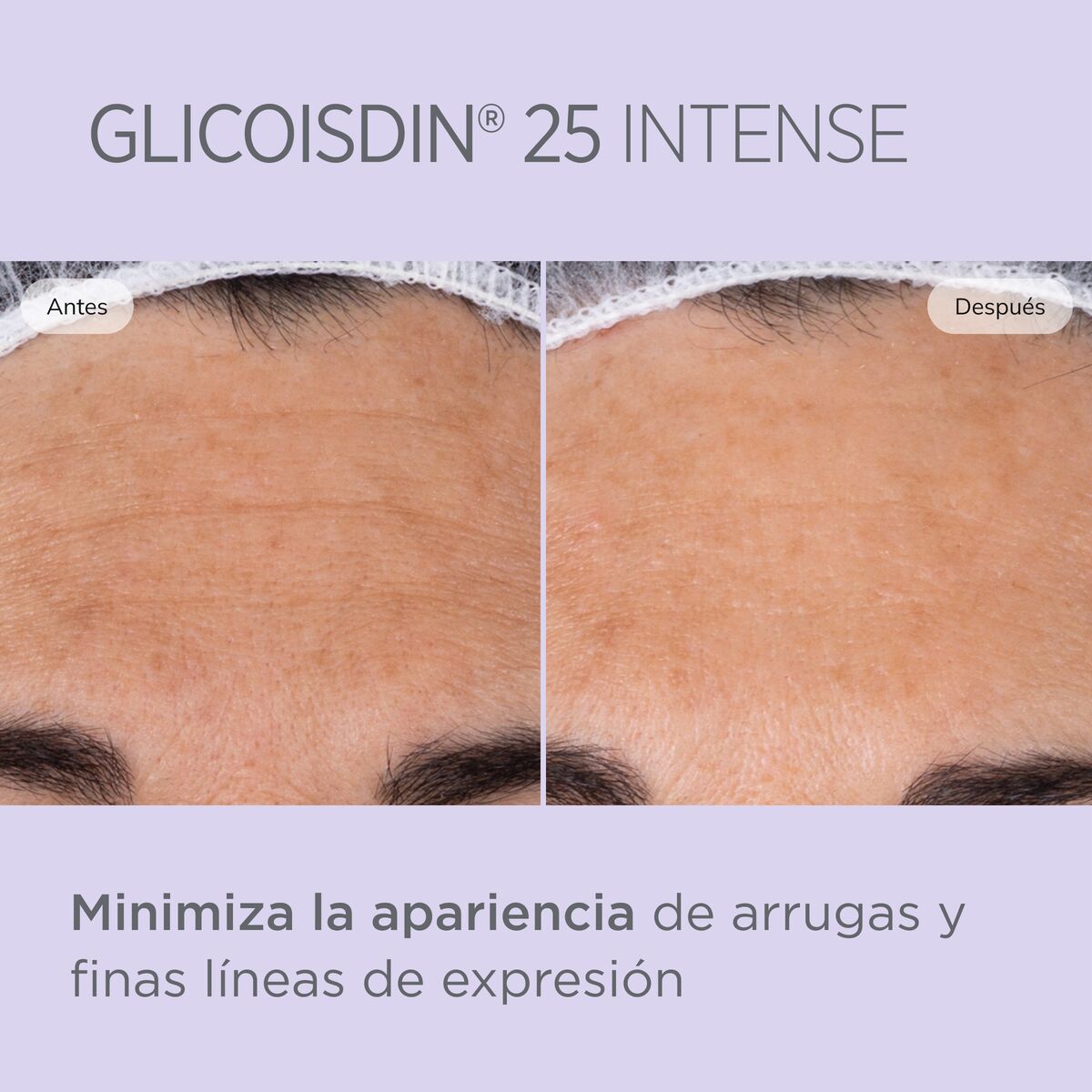 Glicoisdin ®